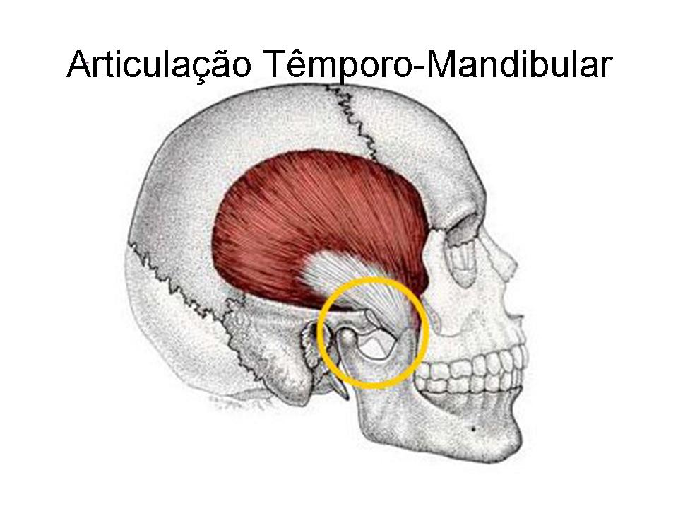 Disfunção da articulação temporomandibular (ATM).